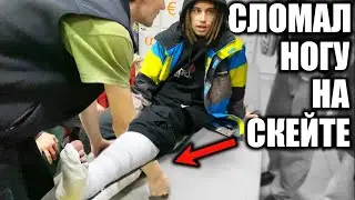 СКЕЙТЕР СЛОМАЛ НОГУ В СКЕЙТ-ПАРКЕ!