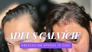 O TONICO PODEROSO REALMENTE FUNCIONA ? TONICO GOLD SPELL ￼#goold #cabelo #crescimento