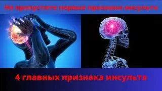 Как организм предупреждает об инсульте?