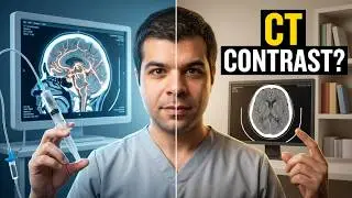 The provider's guide: Contrast vs non-contrast CT?