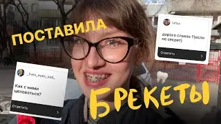 я поставила брекеты // сколько стоит??
