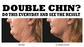 She did this exercise to decrease his chin and see what happen