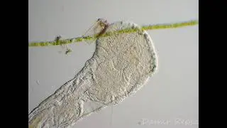 Aeolosoma sp.