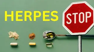 9 Ways to Suppress HSV (Genital Herpes and Cold Sores)