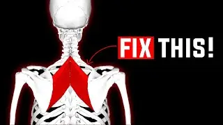 Instant pain relief for neck, shoulder & upper back. Release this muscle!