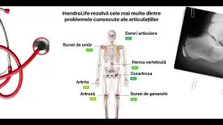hondrglife: România Prețul componentelor, daune, mod de utilizare