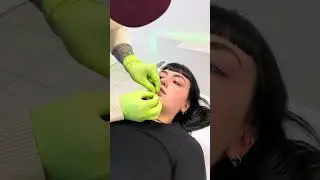VERTICAL LABRET!