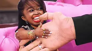 10 PESSOAS RARAS QUE NASCEM UMA VEZ A CADA MIL ANOS