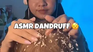 ASMR  Scalp Scratching Dandruff 🌙