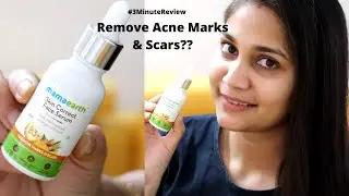 Removes Acne Marks & Scars?  Skin Correct Serum | Is it worth buying? 