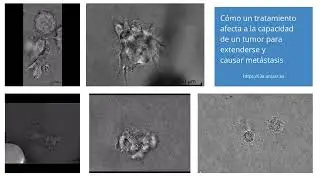 Cómo un novedoso tratamiento afecta a la capacidad de un tumor para extenderse y causar metástasis