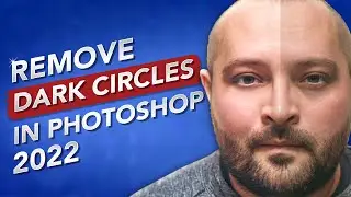 How To Quickly Remove Dark Circles In Adobe Photoshop