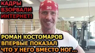 БЕЗ СЛЁЗ НЕ ВЗГЛЯНЕШЬ! Роман Костомаров впервые показал последствия ампутации...