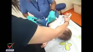 مؤلم جدا 😿 لحظة نزع الجبس )le plate( على رجلي طفل صغير جدا ستشعر بألمه حتما 😞