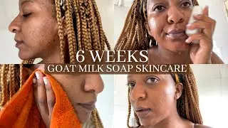 Goat Milk Soap For My Hyperpigmentation, Textured and Oily Skin | Clear Skin 
