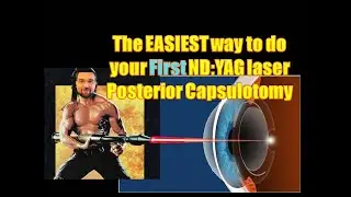 EASIEST way to do your First Nd: YAG laser Posterior Capsulotomy ليزر المحفظة الخلفية لعدسة العين