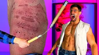 Peeling my Skin Off with SANDPAPER NUNCHUCKS so Nobody else has to *EXTREME RESULTS*