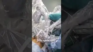 Развитие лапароскопической  хирургии в области лечения онкологии