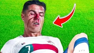 لاعبين كرة القدم الذين كادو ان يموتو