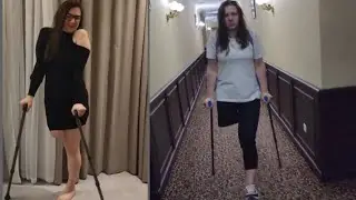 Amputee Lady Crutches Life After Amputation | My Story