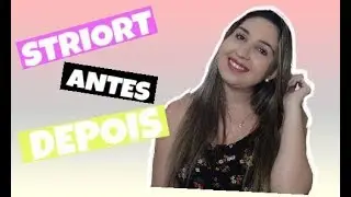 Striort -  ÚLTIMA  SESSÃO | Antes e Depois