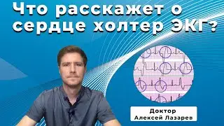 ЧТО РАССКАЖЕТ О СЕРДЦЕ ХОЛТЕР ЭКГ? 