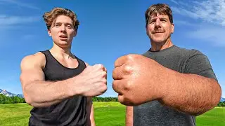 The Man With The World's Largest Arms