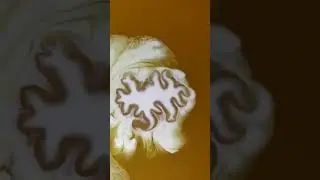 Лимонная кислота и диоксид титана