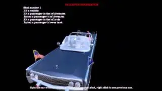 JFK Reloaded (Jag mördar henne genom att skjuta hennes näsa)