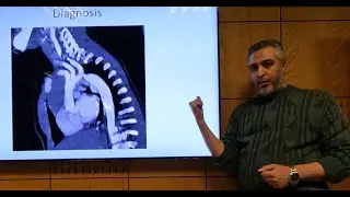 Aortic Coarctation (En) - Hatem Hosny