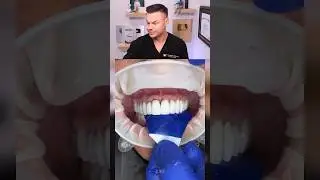 Dentist Reveals Surprising Top Reason For TOOTH Pain! 😭🦷