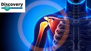 2 Proven Home Remedies for arthritis and Joint Pain | Discovery Health