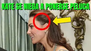 KATE MIDDLETON se NIEGA a ponerse PELUCA por la CAÍDA de PELO