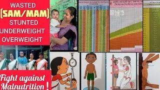 How to identify Wasted (SAM/ MAM)/ Stunted /Underweight children / Growth monitoring devices in AWCs