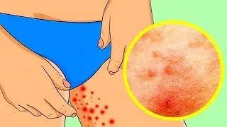 CARA ATASI BERAGAM MASALAH SAAT MUSIM PANAS
