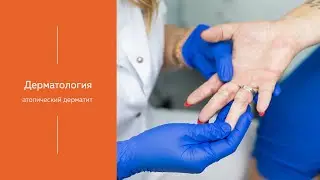 Атопический дерматит | МЕДИЦЕНТР