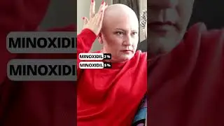 EL  CRECEPELO MÁGICO 👉 Minoxidil 👑✂️📖 #calviciefeminina #minoxidil #crecimientodecabello #alopecia