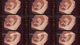 ESTOU GRÁVIDA! 🤰🏼 Parte 3: O primeiro ultrassom e contando para a família do Kevin