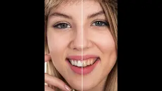 Whiten teeth in 