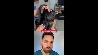 #Duet with @toktok.tv #psoriasis #dandruff