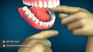 How to Floss Properly - Flossing Technique