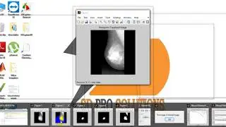 Breast cancer detection using matlab code|final year ece projects consultants at Bangalore
