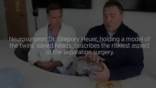 Doctors Discuss Delaney Twins Surgery