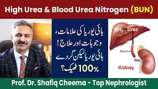 High Urea & Blood Urea Nitrogen (BUN) | Symptoms & Treatment