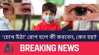 ‘চোখ উঠা’ রোগ হলে কী করবেন, কেন হয়? | সেরা ডাক্তারের পরামর্শ | সূত্র: জাতীয় ই-তথ্যকোষ |