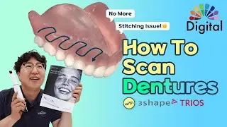 Digital Highlight - How To Properly Scan Full Dentures with 3Shape TRIOS