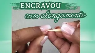 😲unha da mão  encravada como desencravar