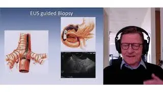 Past, Present and Future of EUS Guided Tissue Acquisition
