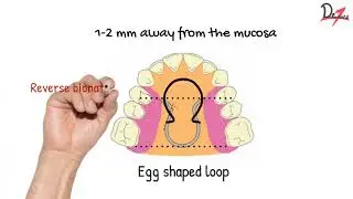 Parts of Bionator