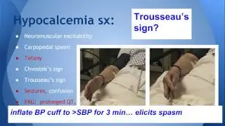 Hypocalcemia